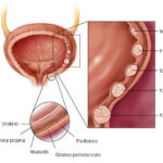 rp_schema-del-cancro-della-vescica.jpg