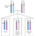 rp_sindrome-di-prader-willi-schema.jpg