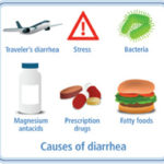 Diarrea : rimedi, cause, cure e prevenzione