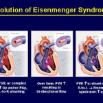 evoluzione della Eisenmenger