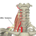 rp_Sindrome-dello-stretto-toracico.jpg