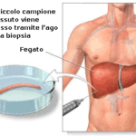 rp_biopsia-epatica.gif