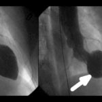fig1