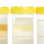 Odore delle urine: cause e malattie